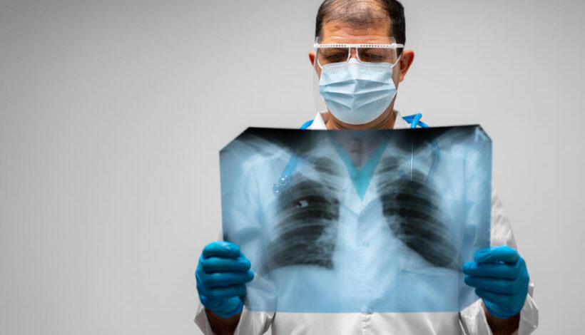 COPD (Chronic Obstructive Pulmonary Disease)